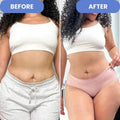 LUMA Pro - Ultrasonic Body Toner & Cellulite Remover
